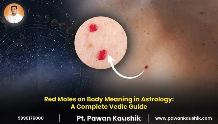Red Moles on Body Meaning in Astrology: A Complete Vedic Guide